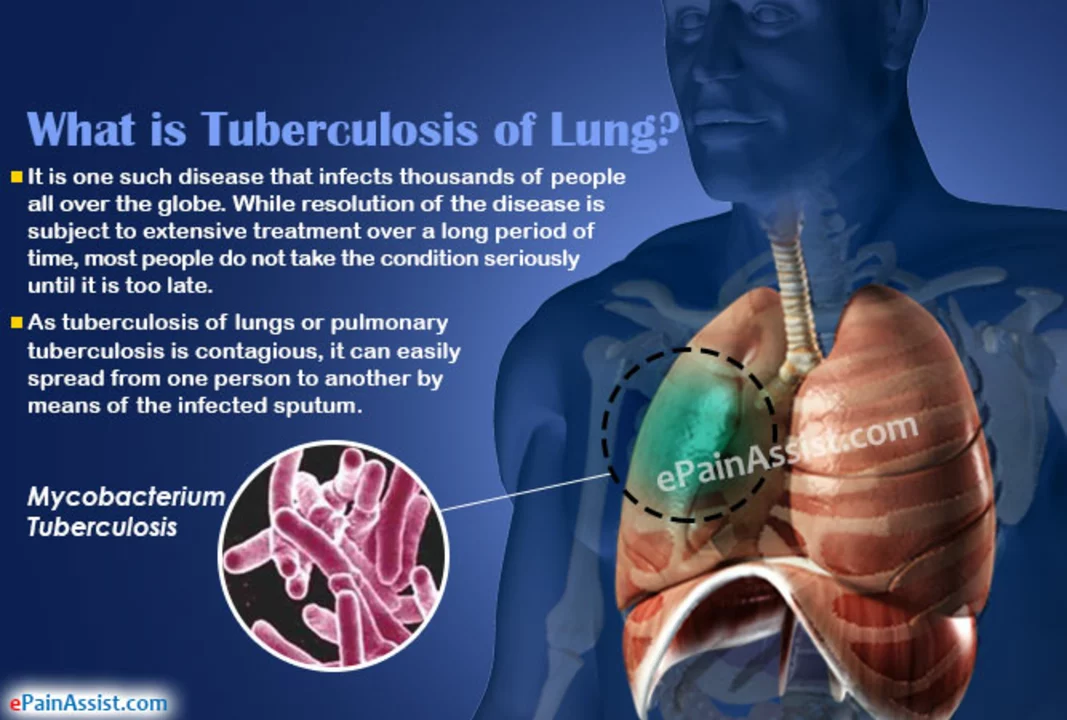 The Use of Traditional Medicine in Pulmonary Tuberculosis Treatment